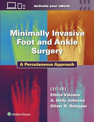 Master Techniques in Orthopaedic Surgery: The Foot and Ankle